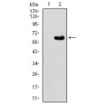 anti-HYAL1 antibody (Hyaluronidase-1) (N-Term)