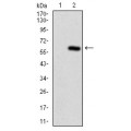 anti-HYAL1 antibody (Hyaluronidase-1) (N-Term)