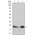 anti-HYAL1 antibody (Hyaluronidase-1) (N-Term)