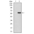 anti-HYAL1 antibody (Hyaluronidase-1) (N-Term)