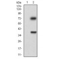 anti-HYAL1 antibody (Hyaluronidase-1) (N-Term)