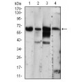 anti-HYAL1 antibody (Hyaluronidase-1) (N-Term)