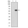 anti-HYAL1 antibody (Hyaluronidase-1) (N-Term)