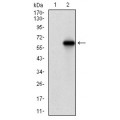 anti-HYAL1 antibody (Hyaluronidase-1) (N-Term)