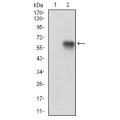 anti-HYAL1 antibody (Hyaluronidase-1) (N-Term)