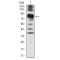 anti-HYAL1 antibody (Hyaluronidase-1) (N-Term)
