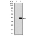 anti-HYAL1 antibody (Hyaluronidase-1) (N-Term)