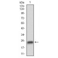 anti-HYAL1 antibody (Hyaluronidase-1) (N-Term)