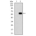 anti-HYAL1 antibody (Hyaluronidase-1) (N-Term)