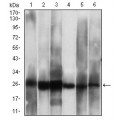 anti-HYAL1 antibody (Hyaluronidase-1) (N-Term)