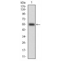 anti-HYAL1 antibody (Hyaluronidase-1) (N-Term)