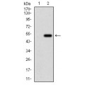 anti-HYAL1 antibody (Hyaluronidase-1) (N-Term)