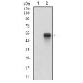 anti-HYAL1 antibody (Hyaluronidase-1) (N-Term)
