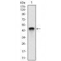 anti-HYAL1 antibody (Hyaluronidase-1) (N-Term)