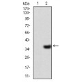 anti-HYAL1 antibody (Hyaluronidase-1) (N-Term)