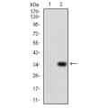 anti-HYAL1 antibody (Hyaluronidase-1) (N-Term)