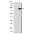 anti-HYAL1 antibody (Hyaluronidase-1) (N-Term)