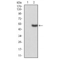 anti-HYAL1 antibody (Hyaluronidase-1) (N-Term)