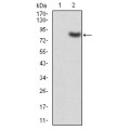 anti-HYAL1 antibody (Hyaluronidase-1) (N-Term)