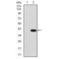 anti-HYAL1 antibody (Hyaluronidase-1) (N-Term)