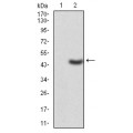 anti-HYAL1 antibody (Hyaluronidase-1) (N-Term)