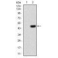 anti-HYAL1 antibody (Hyaluronidase-1) (N-Term)