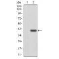 anti-HYAL1 antibody (Hyaluronidase-1) (N-Term)