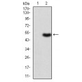 anti-HYAL1 antibody (Hyaluronidase-1) (N-Term)
