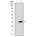 anti-HYAL1 antibody (Hyaluronidase-1) (N-Term)