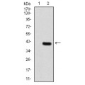 anti-HYAL1 antibody (Hyaluronidase-1) (N-Term)