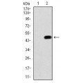 anti-HYAL1 antibody (Hyaluronidase-1) (N-Term)