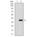 anti-HYAL1 antibody (Hyaluronidase-1) (N-Term)