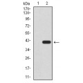 anti-HYAL1 antibody (Hyaluronidase-1) (N-Term)