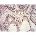 anti-HYAL1 antibody (Hyaluronidase-1) (N-Term)
