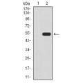anti-HYAL1 antibody (Hyaluronidase-1) (N-Term)