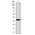 anti-HYAL1 antibody (Hyaluronidase-1) (N-Term)