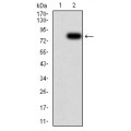 anti-HYAL1 antibody (Hyaluronidase-1) (N-Term)