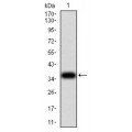 anti-HYAL1 antibody (Hyaluronidase-1) (N-Term)