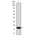 anti-HYAL1 antibody (Hyaluronidase-1) (N-Term)