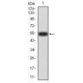 anti-HYAL1 antibody (Hyaluronidase-1) (N-Term)