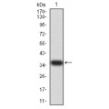 anti-HYAL1 antibody (Hyaluronidase-1) (N-Term)