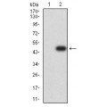 anti-HYAL1 antibody (Hyaluronidase-1) (N-Term)