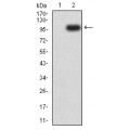 anti-HYAL1 antibody (Hyaluronidase-1) (N-Term)