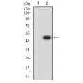 anti-HYAL1 antibody (Hyaluronidase-1) (N-Term)