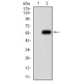 anti-HYAL1 antibody (Hyaluronidase-1) (N-Term)