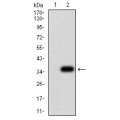anti-HYAL1 antibody (Hyaluronidase-1) (N-Term)
