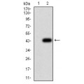 anti-HYAL1 antibody (Hyaluronidase-1) (N-Term)