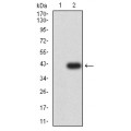 anti-HYAL1 antibody (Hyaluronidase-1) (N-Term)