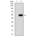 anti-HYAL1 antibody (Hyaluronidase-1) (N-Term)