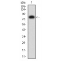 anti-HYAL1 antibody (Hyaluronidase-1) (N-Term)